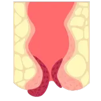 Especialista en Gastroenterología en Cd. Obregón