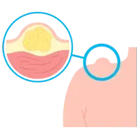 Especialista en Gastroenterología en Cd. Obregón